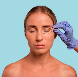 Foto que representa a Blefaroplastia